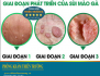 Top 5 Bác Sĩ Hỗ Trợ Điều Trị Sùi Mào Gà An Toàn Tại Nam Định