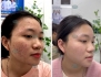 Top 7 Bác Sĩ Điều Trị Mụn Trứng Cá Tốt Nhất – Chuyên Gia Da Liễu Hàng Đầu