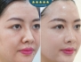 Top 10 Công Nghệ Trẻ Hóa Da Không Xâm Lấn Hiệu Quả Nhất