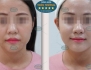 Top 5 Phòng Khám Căng Da Tốt Nhất Nam Định