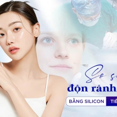 So sánh độn rãnh cười bằng Silicon và tiêm filler