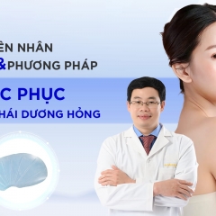 Sửa thái dương hỏng? Nguyên nhân và phương pháp khắc phục độn thái dương hỏng