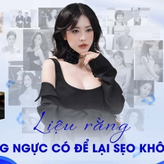 Nâng ngực không sẹo lựa chọn hàng đầu cho chị em phụ nữ