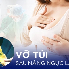  Sửa ngực vỡ túi: Nguyên nhân, dấu hiệu và giải pháp nâng ngực an toàn, hiệu quả