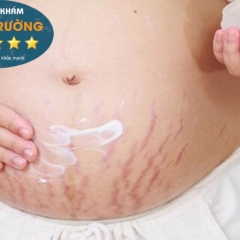 Top 5 Địa Chỉ Điều Trị Rạn Da Sau Sinh Uy Tín Và Hiệu Quả Nhất