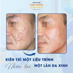 Top 7 Công Nghệ Tái Tạo Da Giúp Phục Hồi Da Sau Tổn Thương Tốt Nhất