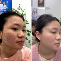 Top 7 Bác Sĩ Điều Trị Mụn Trứng Cá Tốt Nhất – Chuyên Gia Da Liễu Hàng Đầu