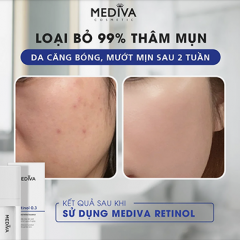 Kem đặc trị mụn, nám , tàn nhang Mediva Retinol Rejuvenating Combo