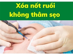 Tẩy Xóa Nốt Ruồi, Đi Trị Thâm Do Tự Phá Nốt Ruồi Tại Nhà Spa Uy Tín Hiệu Quả Nhất Quận 12, Gần Hóc Môn, Củ Chi 