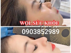 Spa Tiêm Filler Uy Tín Quận 6 - Spa Tiêm Filler Uy Tín Quận Tân Phú