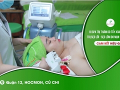 Sẹo Thủy Đậu, Sẹo Do Xóa Nốt Ruồi Sai Cách Spa Xoá Sẹo, Sẹo Thâm Trị Sẹo Rỗ Ở Spa, Spa Điều Trị Sẹo Lồi, Sẹo Lõm, Sẹo Bỏng Bô, Sẹo Té Xe  Uy Gần Đường Nguyễn Ảnh Thủ Hóc Môn, Quận 12 Củ Chi 